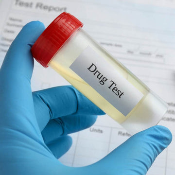 Drug Testing at Work: Understanding Workers' Rights